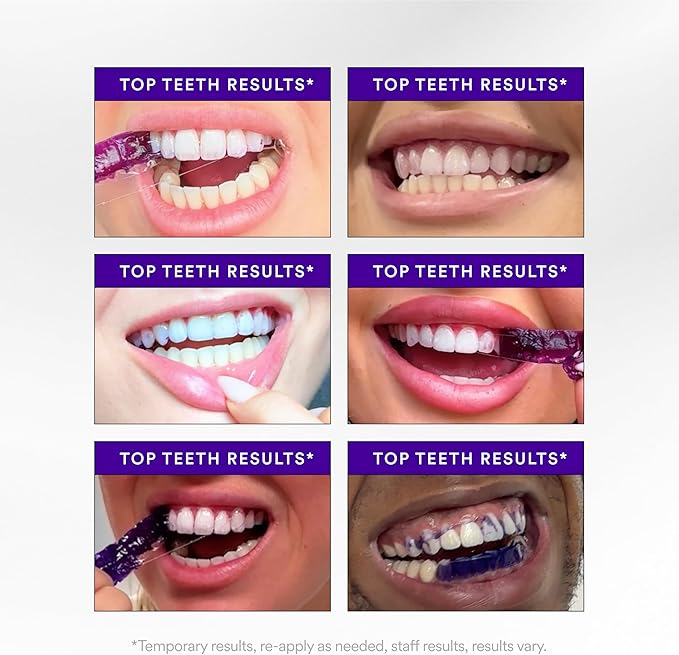 Purple Teeth Whitening Strips – Gentle Daily Purple Whitening Strips for Surface Stain Reduction & Natural Shine, Portable Whitening Strips Purple for Home or On-The-Go Use (14)